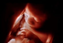 Innovative Bildgebungs-Tools von Philips ermöglichen lebensechte 3D-Ultraschallbilder von Ungeborenen
