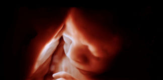 Innovative Bildgebungs-Tools von Philips ermöglichen lebensechte 3D-Ultraschallbilder von Ungeborenen