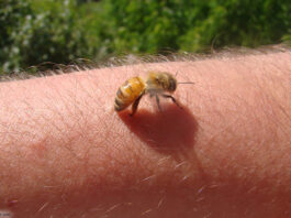 Biene Insekt Stich Arm