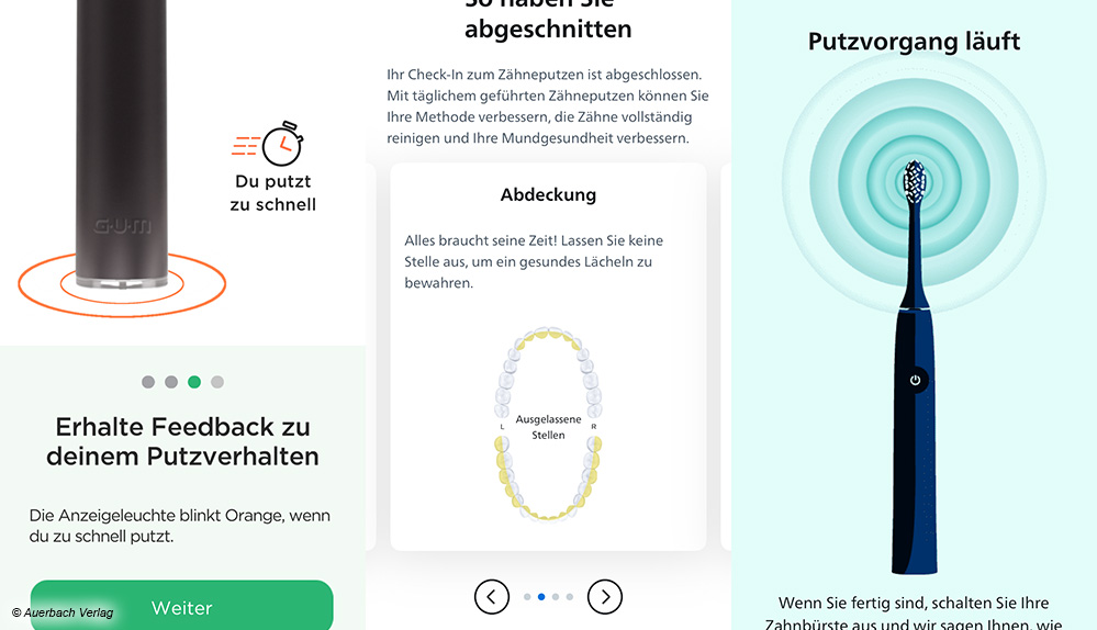 Detaillierte Putzstatistik bei Sonicare: Mit der frei in den Appstores erhältlichen App wird nicht nur die Putzzeit, sondern auch Regelmäßigkeit und Genauigkeit dokumentiert und ausgewertet
